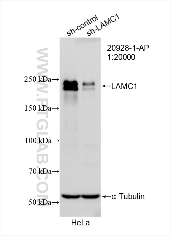 Western Blot (WB) analysis of HeLa cells using LAMC1 Polyclonal antibody (20928-1-AP)