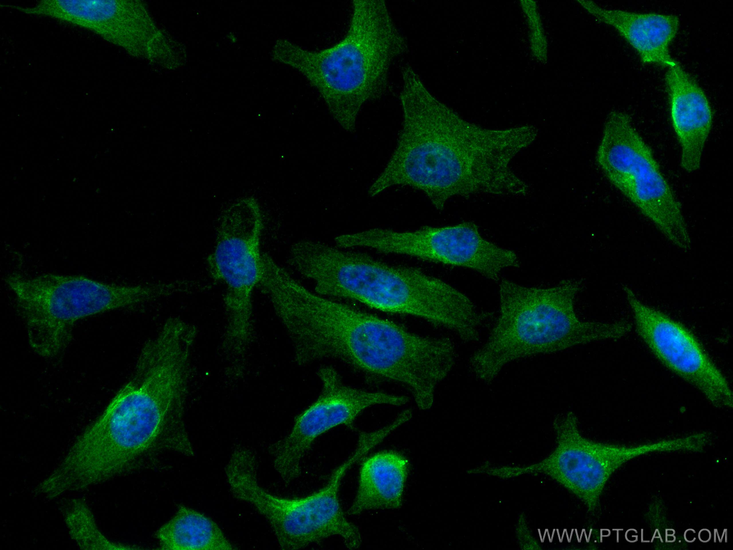 Immunofluorescence (IF) / fluorescent staining of HeLa cells using LAMC1 Monoclonal antibody (67706-1-Ig)