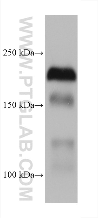 Western Blot (WB) analysis of human placenta tissue using LAMC1 Monoclonal antibody (67706-1-Ig)