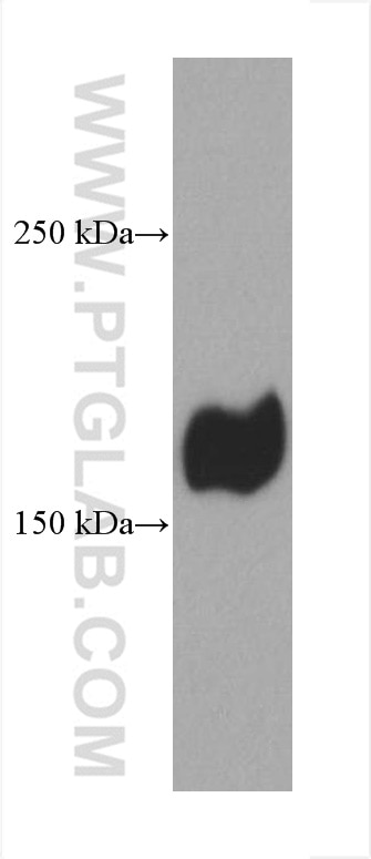 Western Blot (WB) analysis of LNCaP cells using LAMC1 Monoclonal antibody (67706-1-Ig)