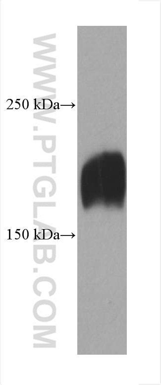 Western Blot (WB) analysis of rat rectum tissue using LAMC1 Monoclonal antibody (67706-1-Ig)