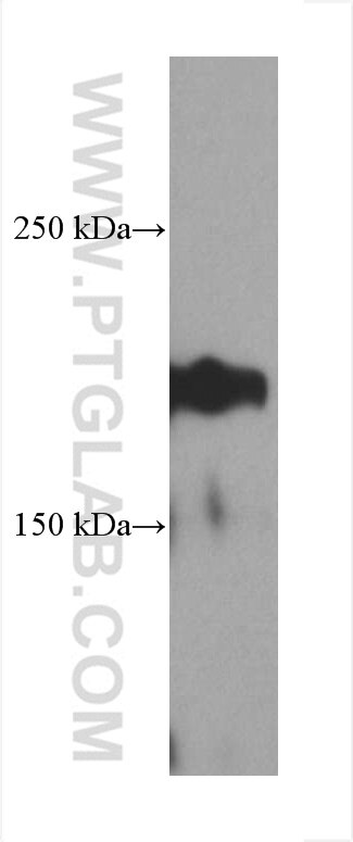 Western Blot (WB) analysis of pig rectum tissue using LAMC1 Monoclonal antibody (67706-1-Ig)