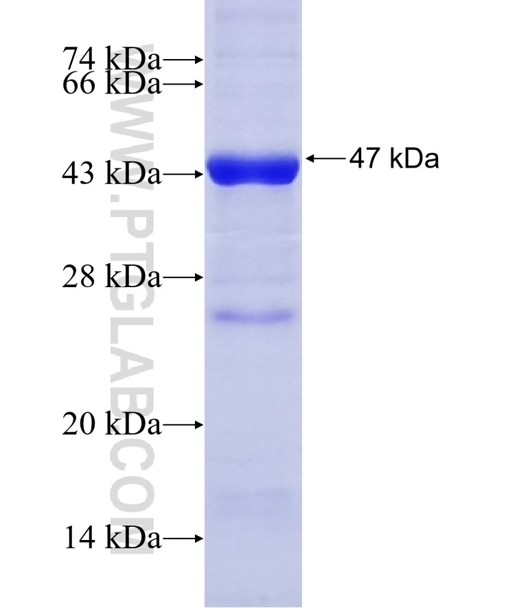 LAMC1 fusion protein Ag14674 SDS-PAGE