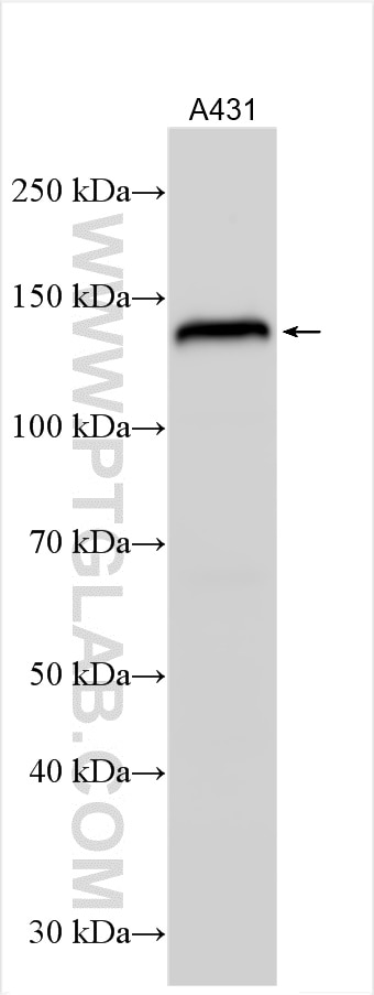 Western Blot (WB) analysis of A431 cells using LAMC2 Polyclonal antibody (19698-1-AP)