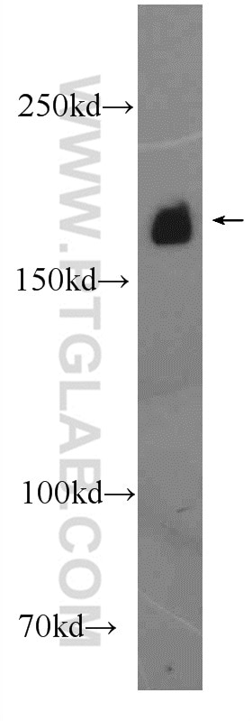 Western Blot (WB) analysis of mouse brain tissue using LAMC3-Specific Polyclonal antibody (20030-1-AP)