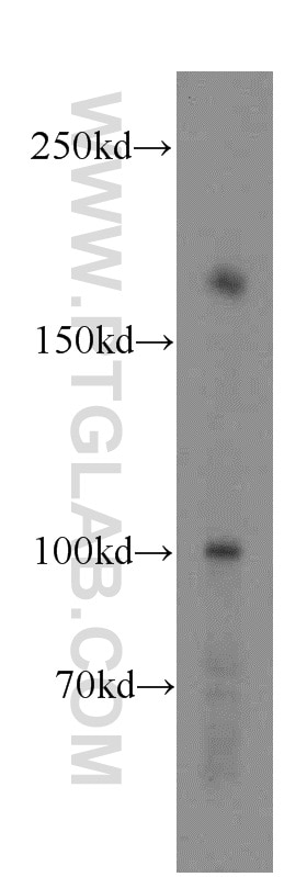 Western Blot (WB) analysis of human placenta tissue using LAMC3-Specific Polyclonal antibody (20030-1-AP)