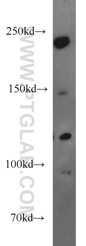 Western Blot (WB) analysis of HEK-293 cells using LAMC3-Specific Polyclonal antibody (20030-1-AP)