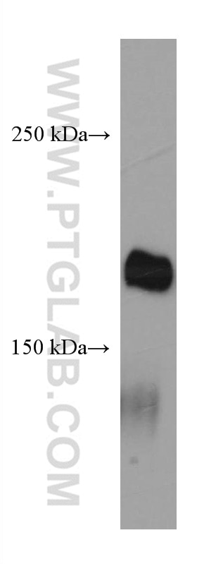 Western Blot (WB) analysis of human testis tissue using LAMC3-Specific Monoclonal antibody (67261-1-Ig)