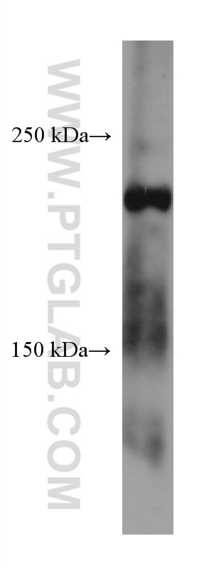 Western Blot (WB) analysis of mouse placenta tissue using LAMC3-Specific Monoclonal antibody (67261-1-Ig)