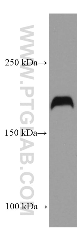 Western Blot (WB) analysis of PC-3 cells using LAMC3-Specific Monoclonal antibody (67261-1-Ig)
