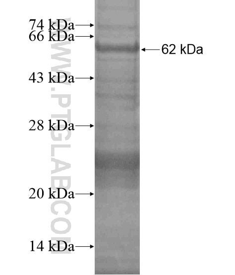 LAMC3-Specific fusion protein Ag19464 SDS-PAGE