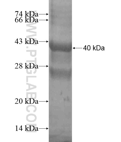 LAMC3-Specific fusion protein Ag19465 SDS-PAGE