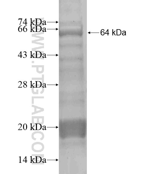 LAMC3-Specific fusion protein Ag19568 SDS-PAGE