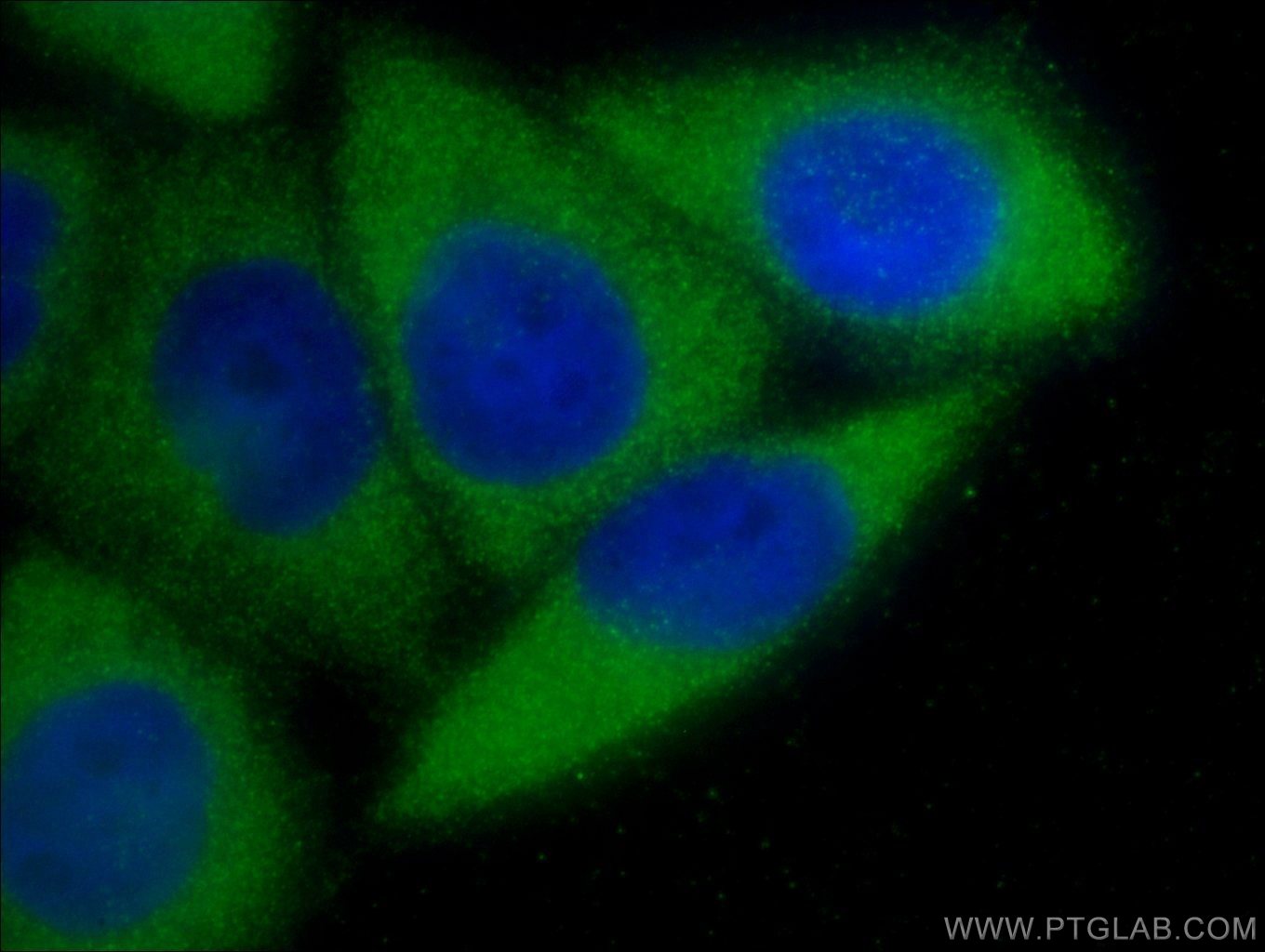 Immunofluorescence (IF) / fluorescent staining of HeLa cells using CD107a / LAMP1 Polyclonal antibody (55273-1-AP)