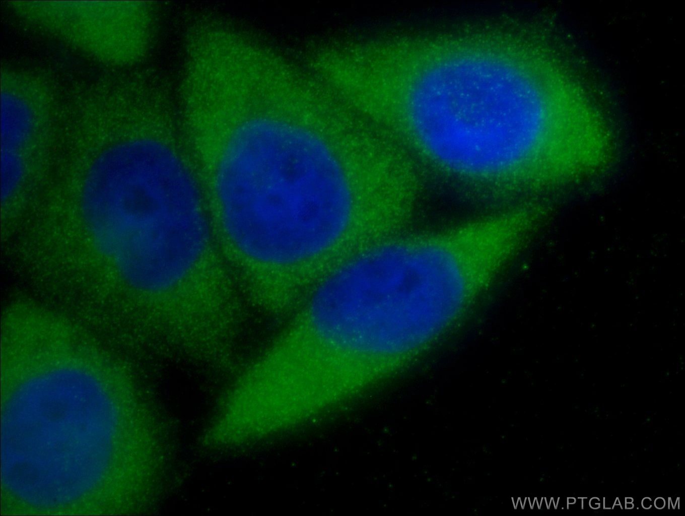 IF Staining of HeLa using 55273-1-AP