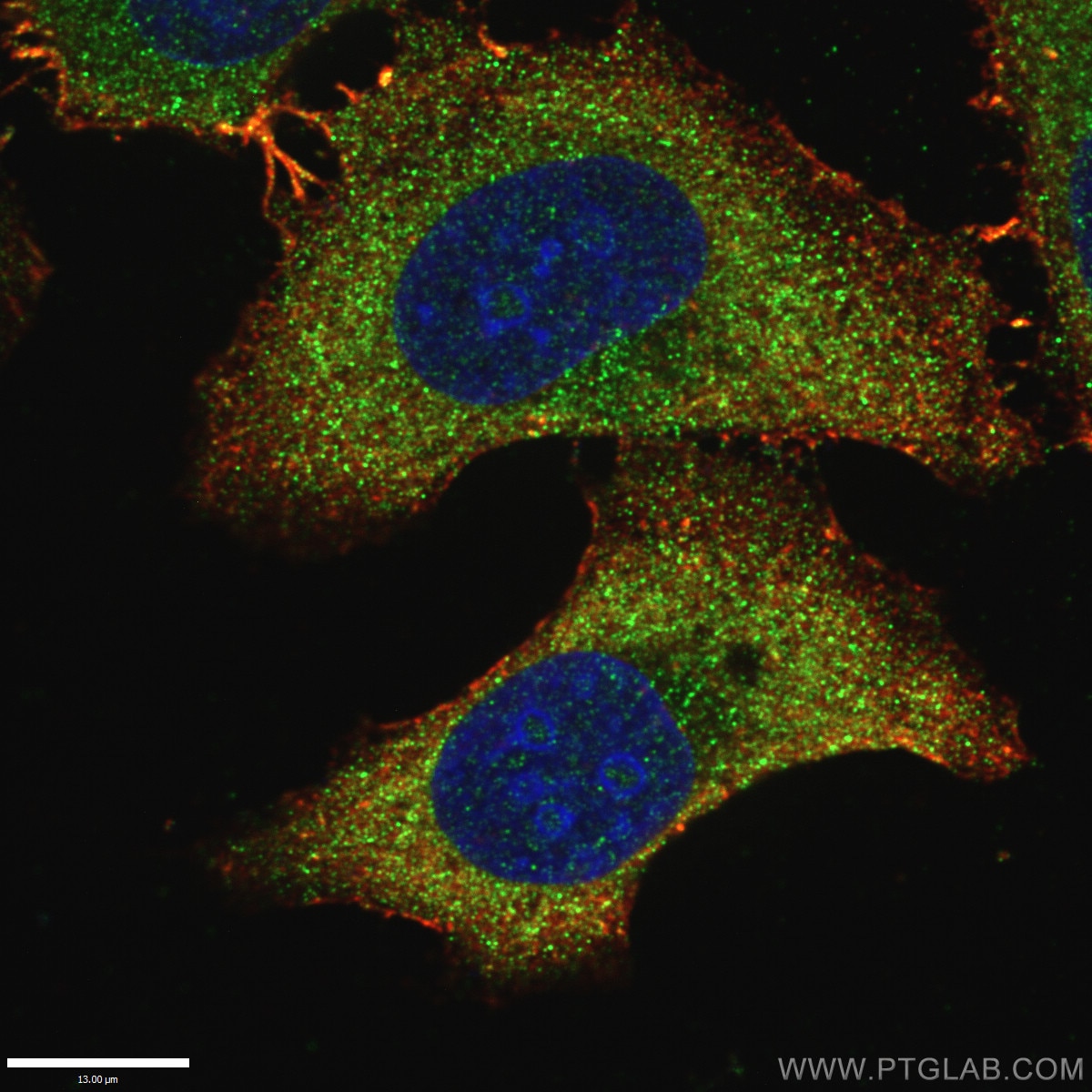 CD107a / LAMP1 Polyclonal antibody