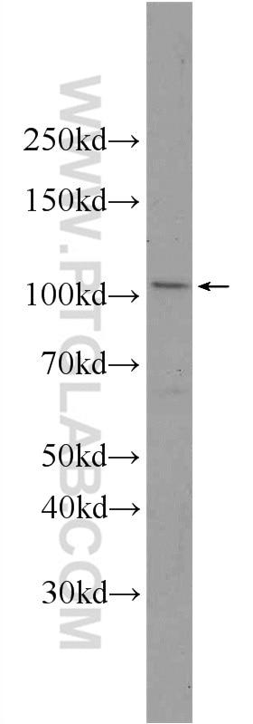 CD107a / LAMP1 Polyclonal antibody
