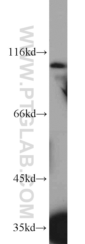 Western Blot (WB) analysis of human brain tissue using CD107a / LAMP1 Polyclonal antibody (55273-1-AP)