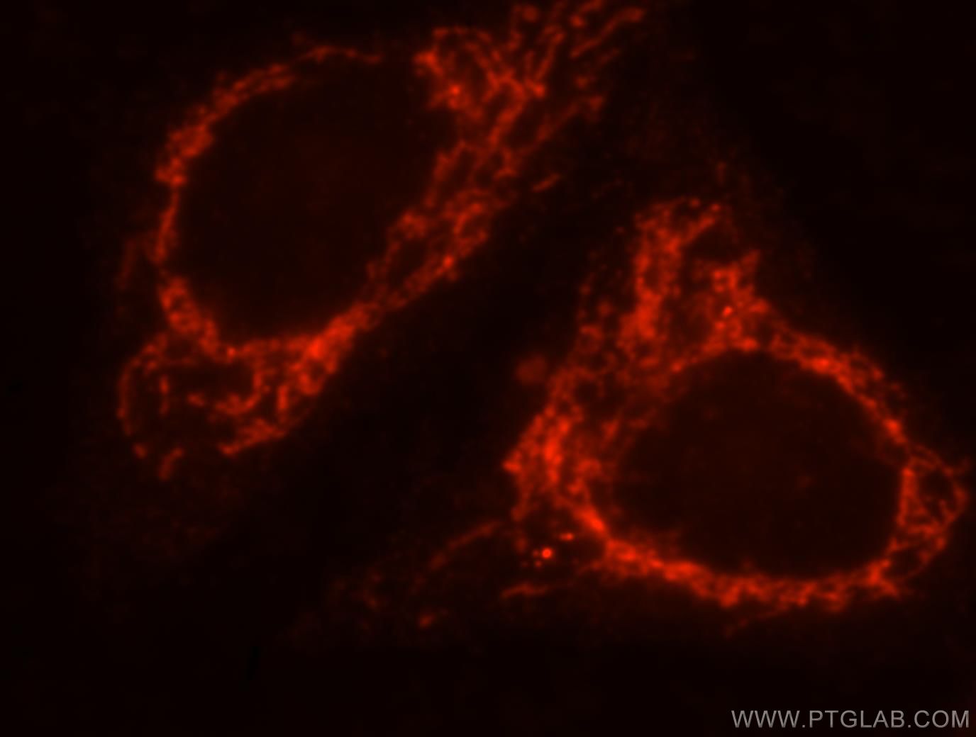 Immunofluorescence (IF) / fluorescent staining of HepG2 cells using CD107b / LAMP2 Polyclonal antibody (10397-1-AP)