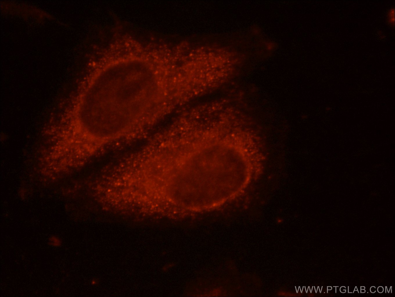 Immunofluorescence (IF) / fluorescent staining of HepG2 cells using CD107b / LAMP2 Polyclonal antibody (10397-1-AP)