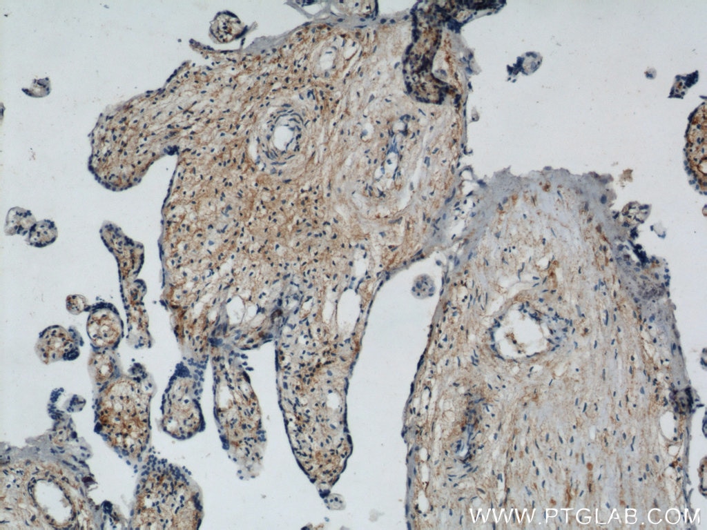 Immunohistochemistry (IHC) staining of human placenta tissue using CD107b / LAMP2 Polyclonal antibody (10397-1-AP)