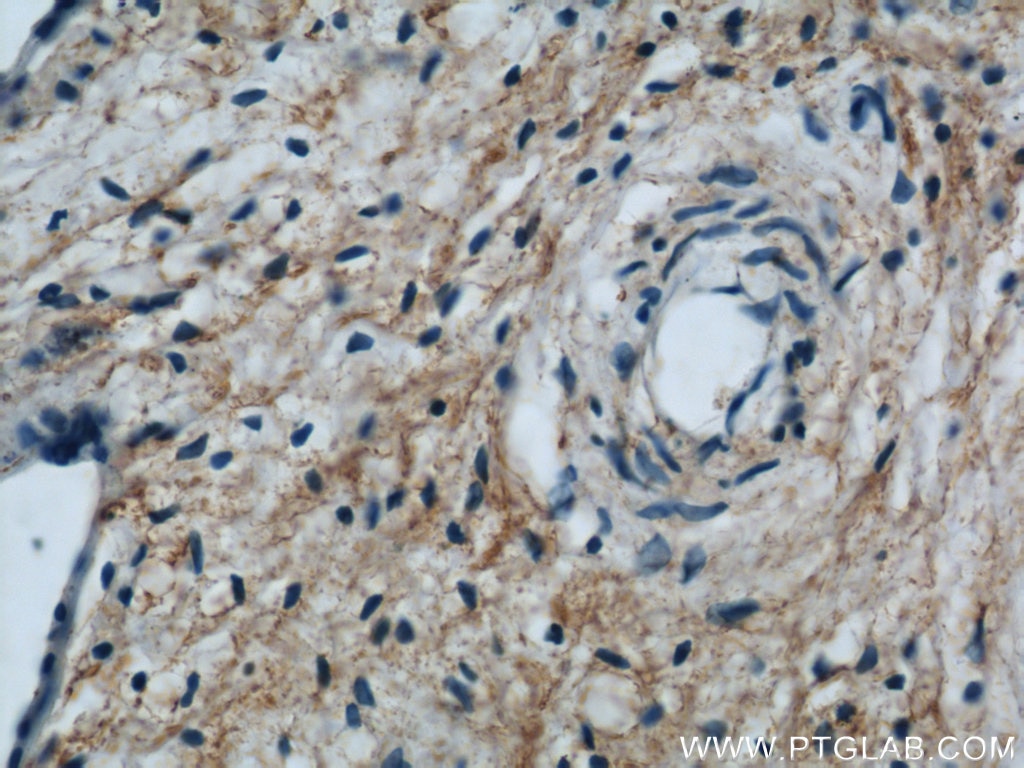 Immunohistochemistry (IHC) staining of human placenta tissue using CD107b / LAMP2 Polyclonal antibody (10397-1-AP)