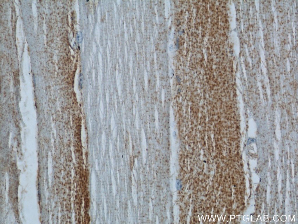 Immunohistochemistry (IHC) staining of human skeletal muscle tissue using CD107b / LAMP2 Polyclonal antibody (10397-1-AP)