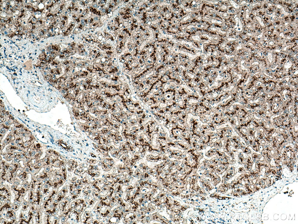 Immunohistochemistry (IHC) staining of human liver tissue using CD107b / LAMP2 Polyclonal antibody (27823-1-AP)