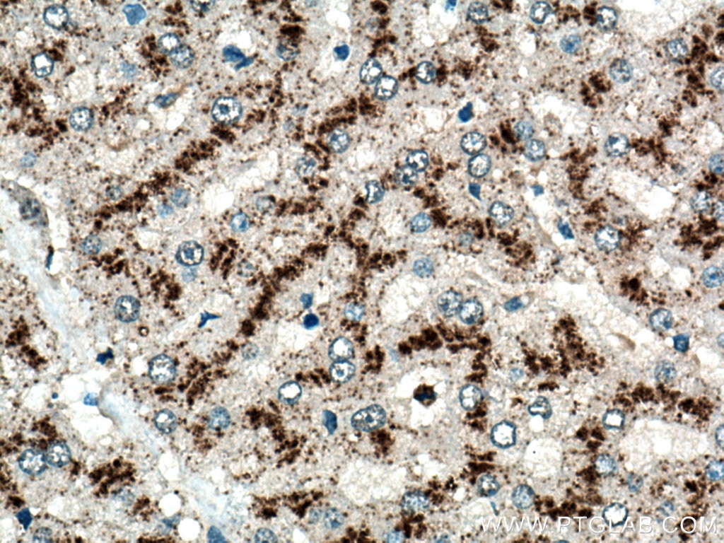 Immunohistochemistry (IHC) staining of human liver tissue using CD107b / LAMP2 Polyclonal antibody (27823-1-AP)