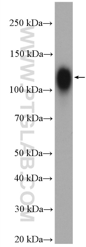 Western Blot (WB) analysis of Jurkat cells using CD107b / LAMP2 Polyclonal antibody (27823-1-AP)