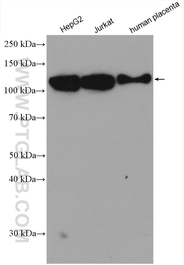 Western Blot (WB) analysis of various lysates using CD107b / LAMP2 Polyclonal antibody (27823-1-AP)