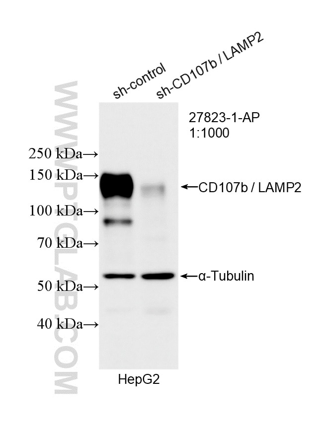 WB result of CD107b / LAMP2 antibody (27823-1-AP; 1:1000; incubated at room temperature for 1.5 hours) with sh-Control and sh-CD107b / LAMP2 transfected HepG2 cells. Western Blot (WB) analysis of HepG2 cells using CD107b / LAMP2 Polyclonal antibody (27823-1-AP)