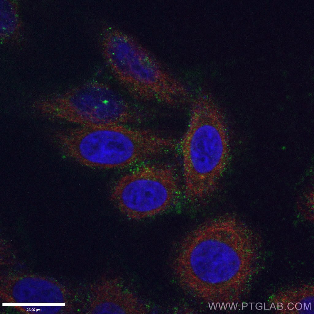 Immunofluorescence (IF) / fluorescent staining of HepG2 cells using CD107b / LAMP2 Monoclonal antibody (66301-1-Ig)