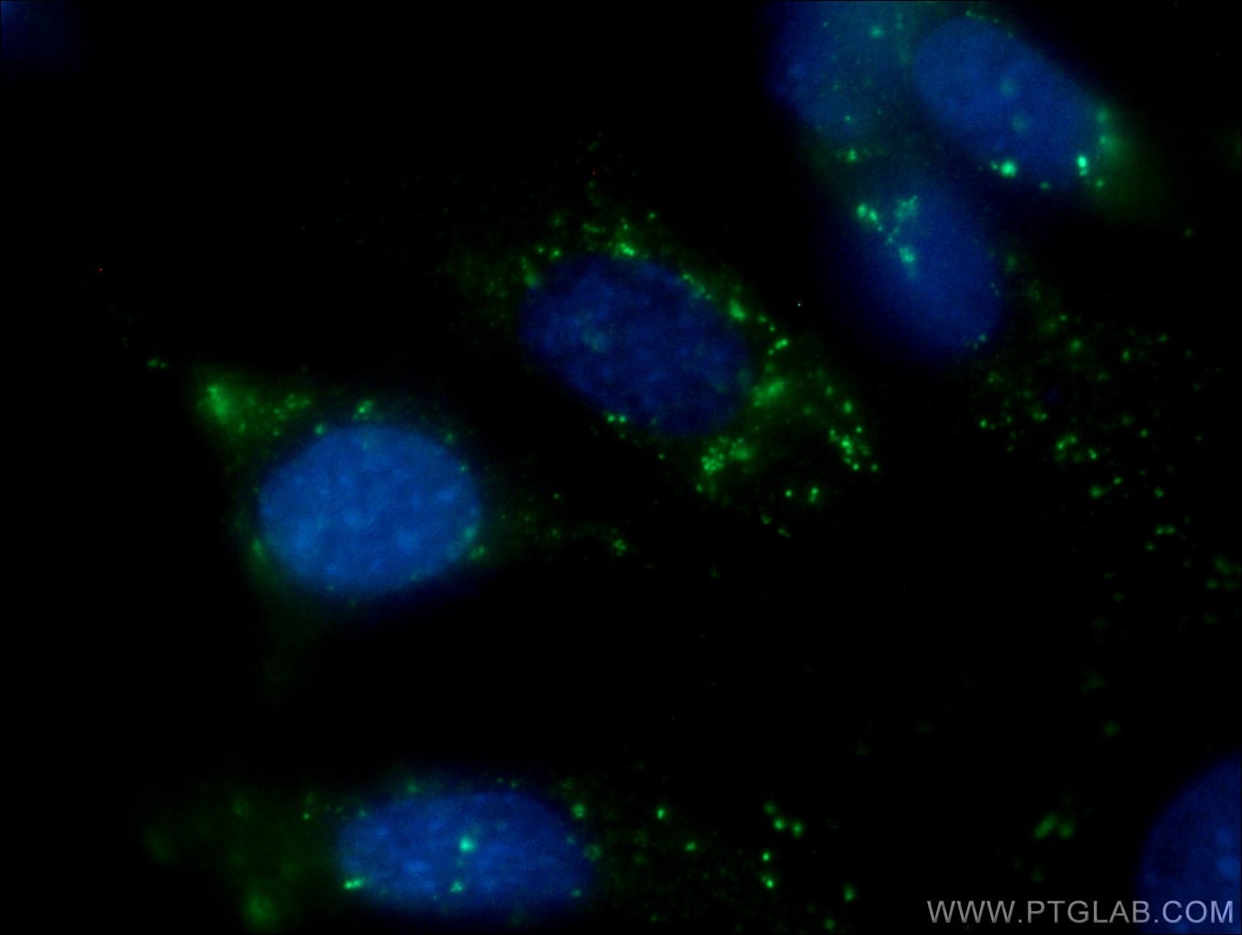 Immunofluorescence (IF) / fluorescent staining of 3T3-L1 cells using CD107b / LAMP2 Monoclonal antibody (66301-1-Ig)