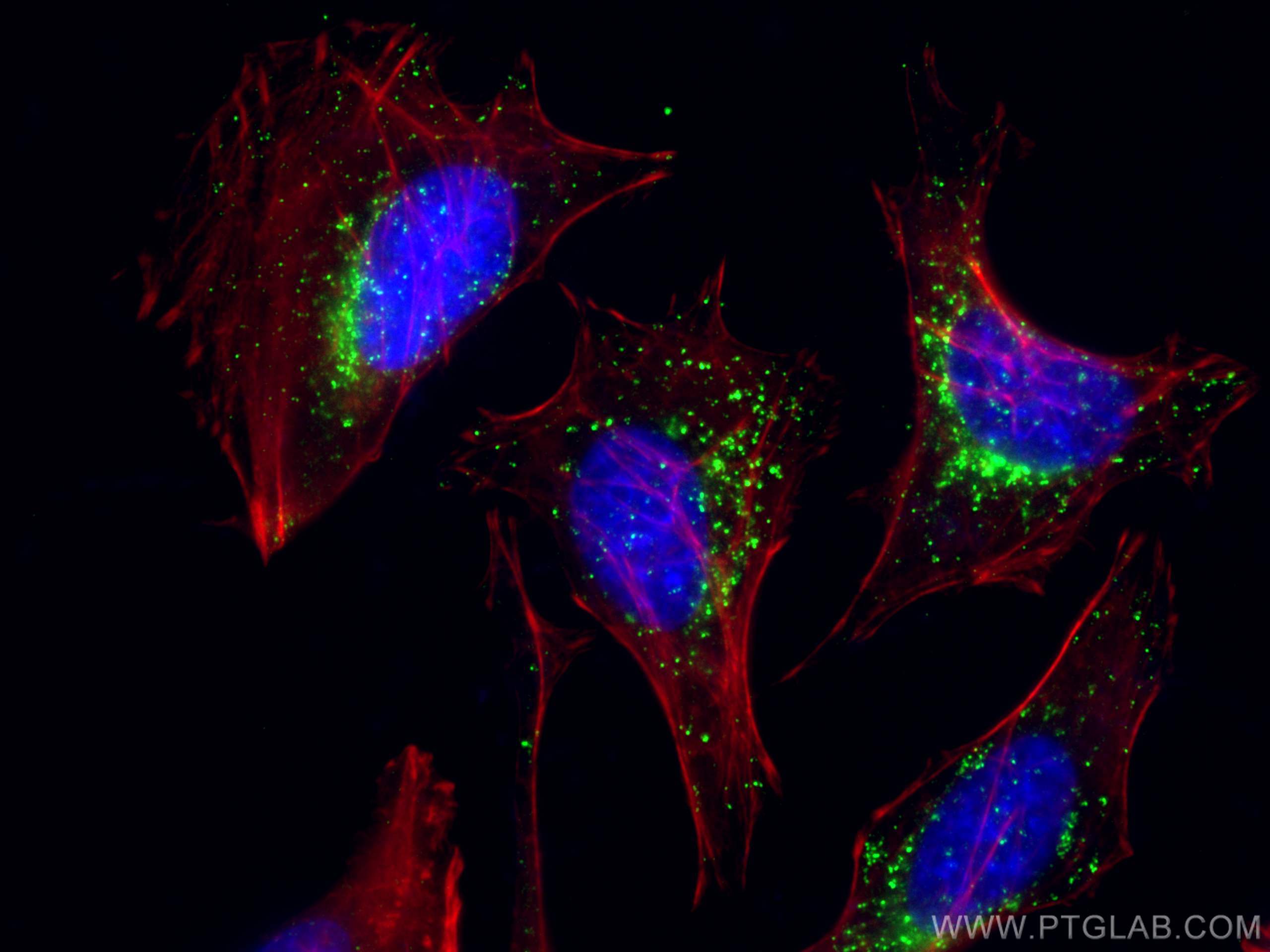 Immunofluorescence (IF) / fluorescent staining of HeLa cells using CD107b / LAMP2 Monoclonal antibody (66301-1-Ig)