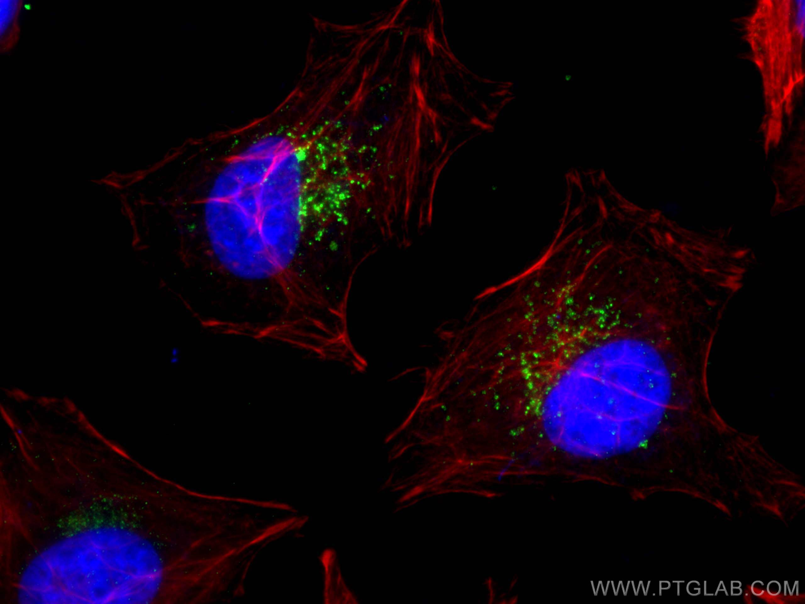 Immunofluorescence (IF) / fluorescent staining of HeLa cells using CD107b / LAMP2 Monoclonal antibody (66301-1-Ig)