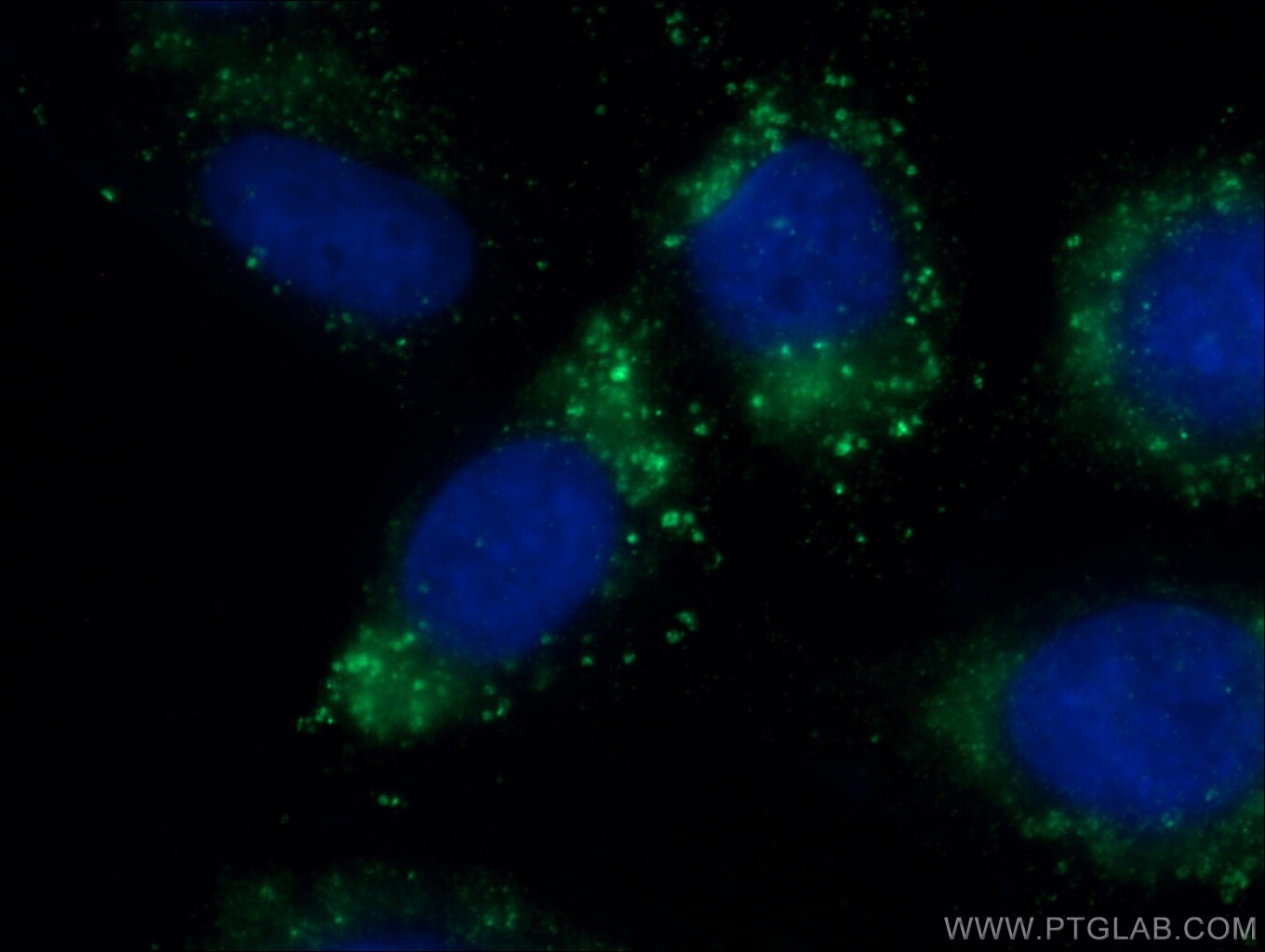 Immunofluorescence (IF) / fluorescent staining of HepG2 cells using CD107b / LAMP2 Monoclonal antibody (66301-1-Ig)