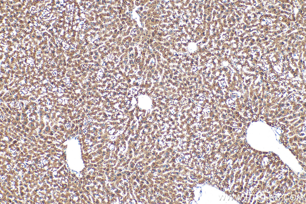 Immunohistochemistry (IHC) staining of mouse liver tissue using CD107b / LAMP2 Monoclonal antibody (66301-1-Ig)