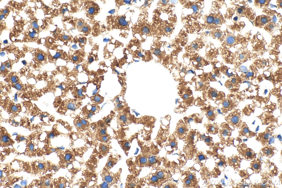 Immunohistochemistry (IHC) staining of mouse liver tissue using CD107b / LAMP2 Monoclonal antibody (66301-1-Ig)