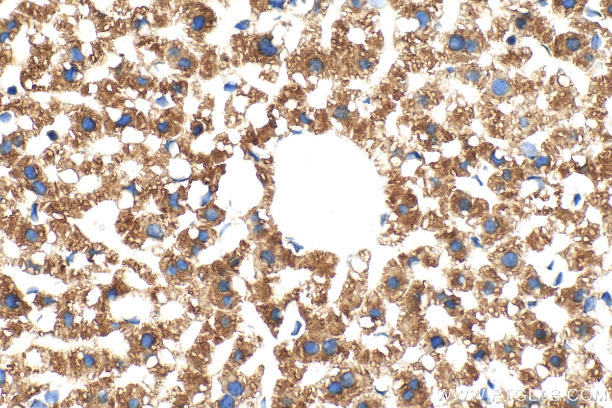 IHC staining of mouse liver using 66301-1-Ig