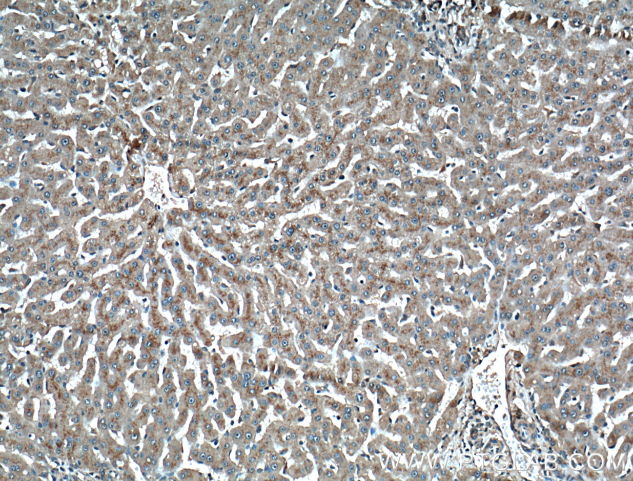 Immunohistochemistry (IHC) staining of human liver tissue using CD107b / LAMP2 Monoclonal antibody (66301-1-Ig)