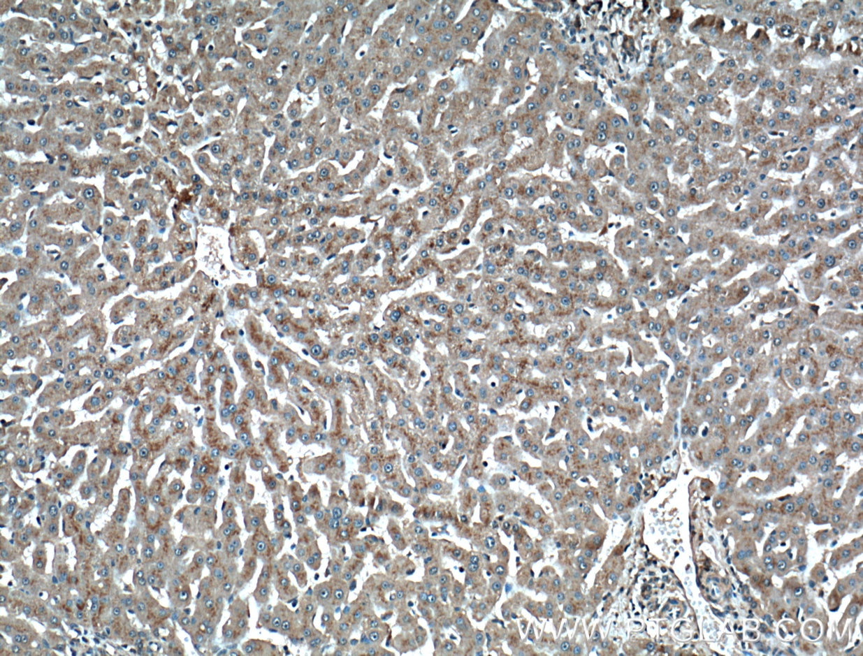 IHC staining of human liver using 66301-1-Ig