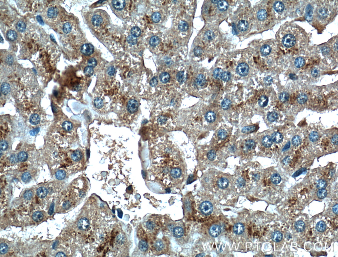 Immunohistochemistry (IHC) staining of human liver tissue using CD107b / LAMP2 Monoclonal antibody (66301-1-Ig)