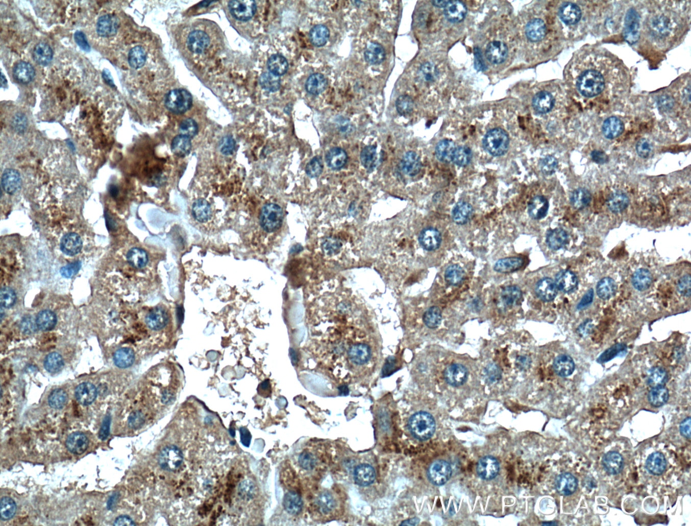 IHC staining of human liver using 66301-1-Ig