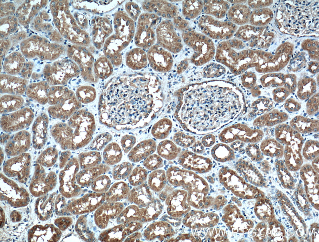 Immunohistochemistry (IHC) staining of human kidney tissue using CD107b / LAMP2 Monoclonal antibody (66301-1-Ig)