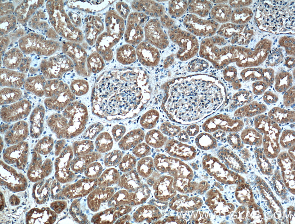 IHC staining of human kidney using 66301-1-Ig