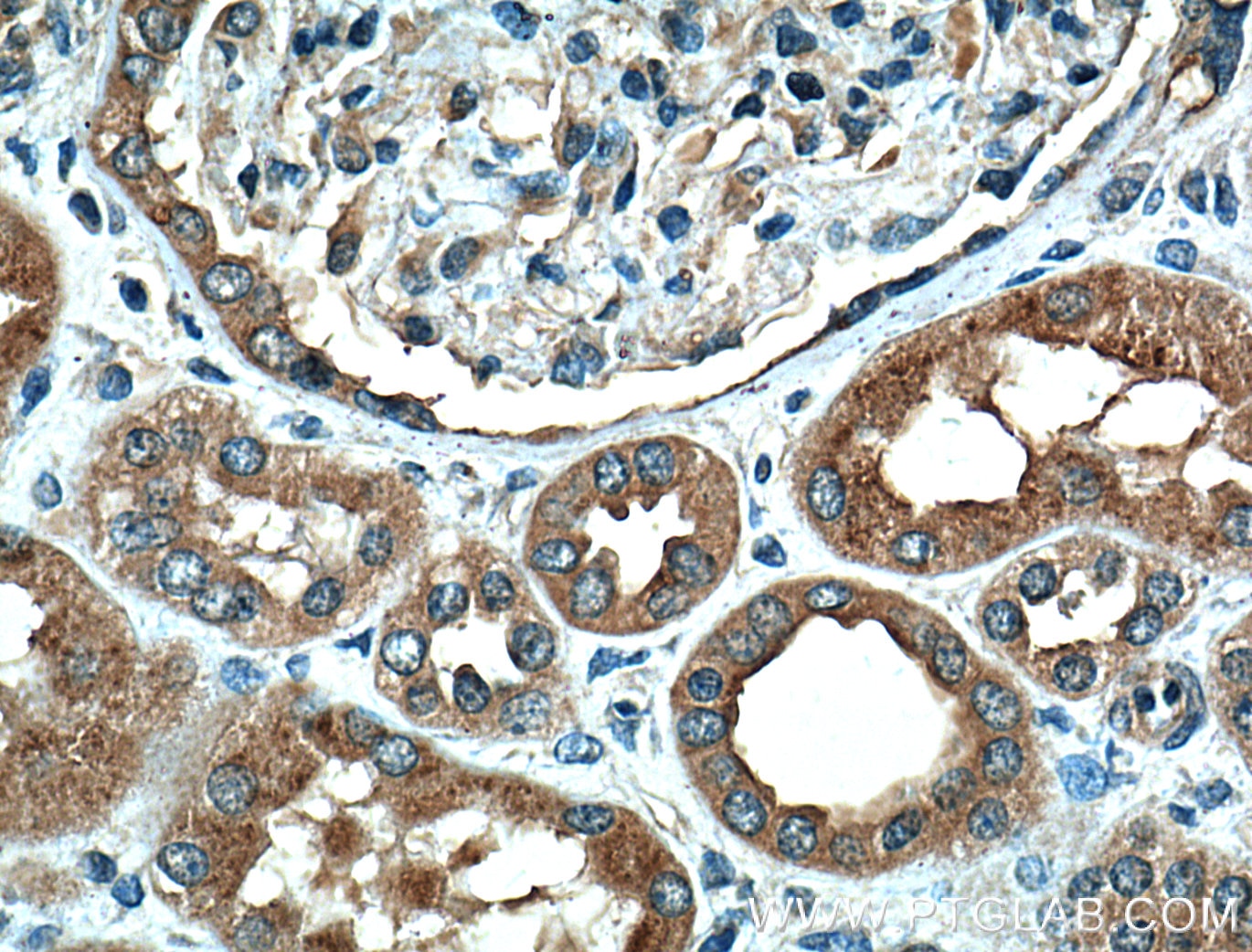 Immunohistochemistry (IHC) staining of human kidney tissue using CD107b / LAMP2 Monoclonal antibody (66301-1-Ig)