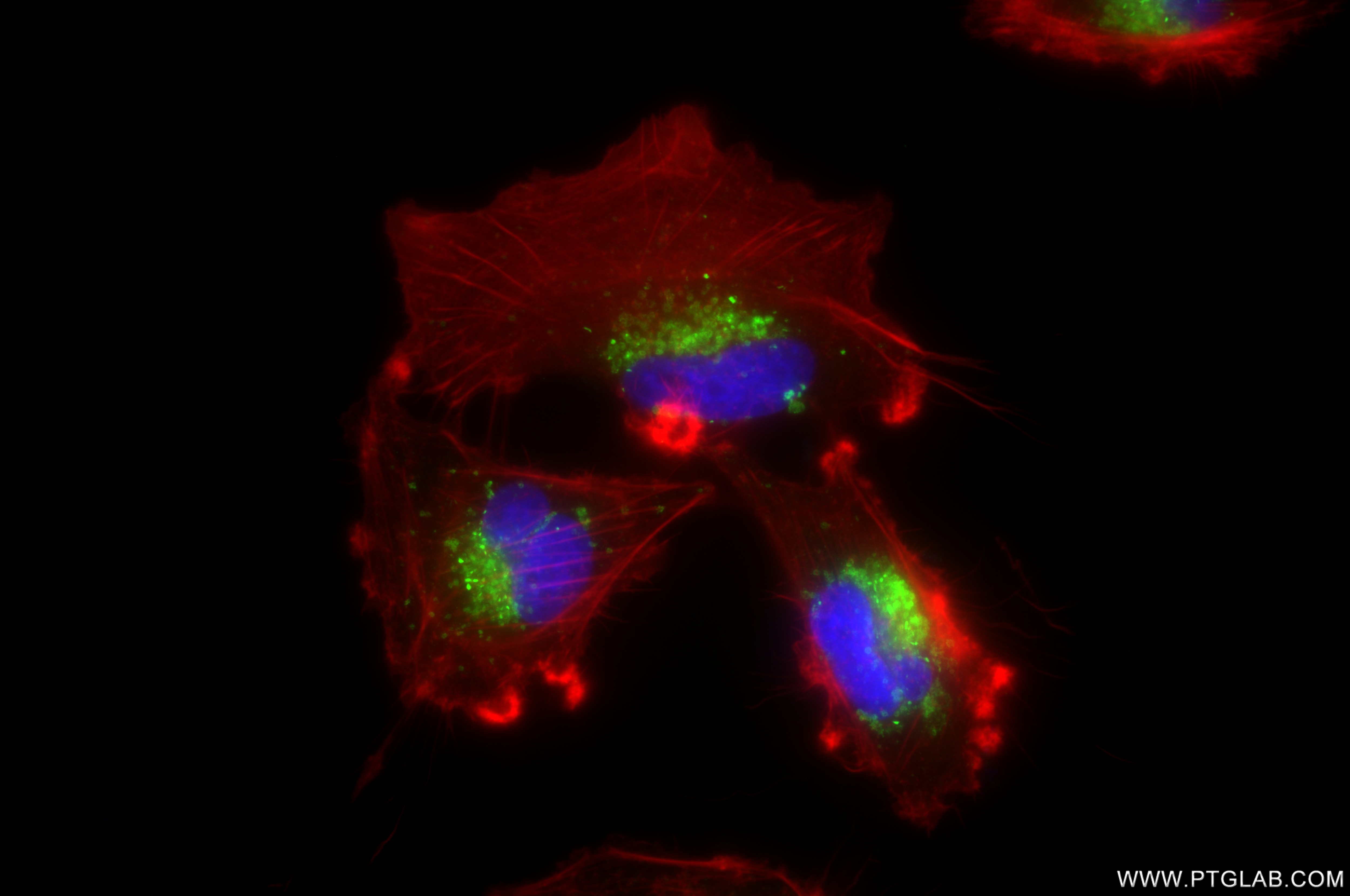 Immunofluorescence (IF) / fluorescent staining of U-251 cells using LAMP2/ CD107b Recombinant antibody (86269-3-RR)
