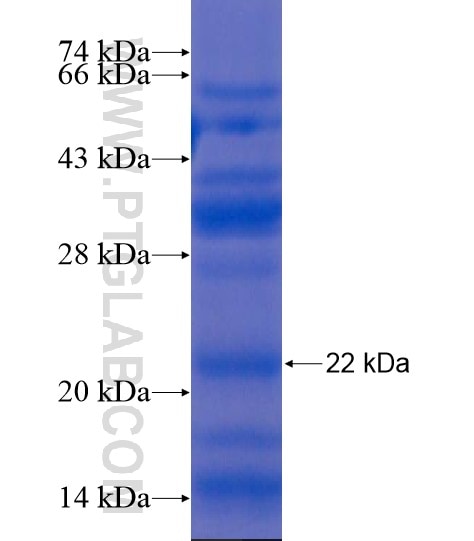 LAMP2 fusion protein Ag20360 SDS-PAGE