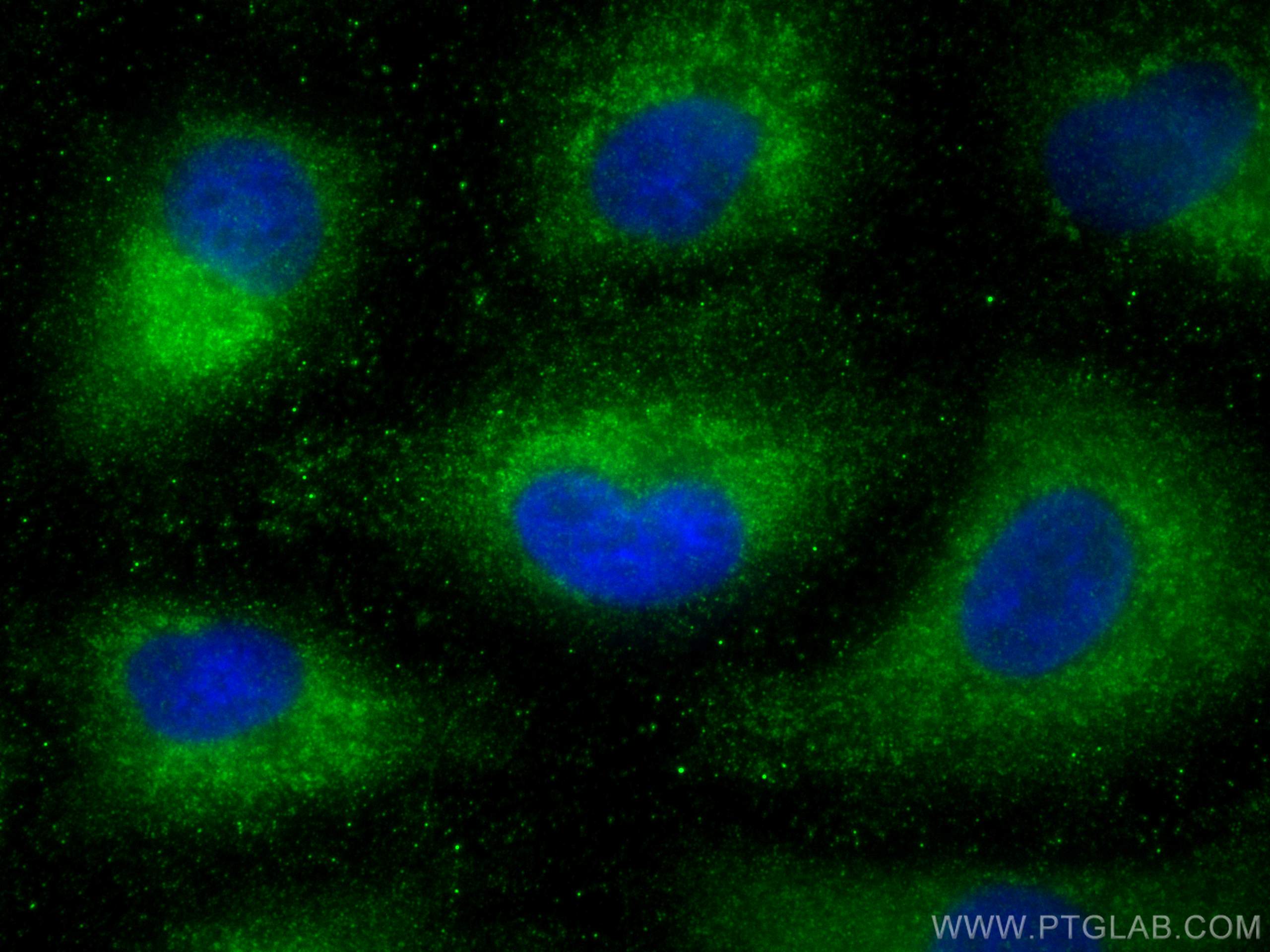 Immunofluorescence (IF) / fluorescent staining of A549 cells using LAMP3 Polyclonal antibody (12632-1-AP)